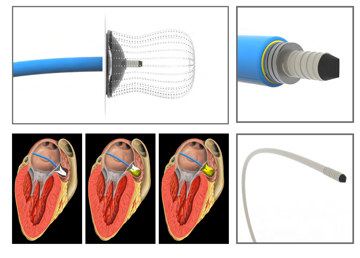 Anatomy & Engineering
