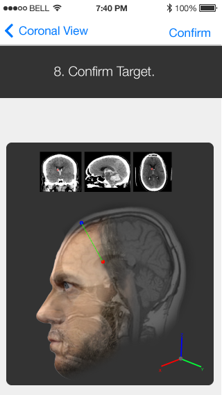 Outcome