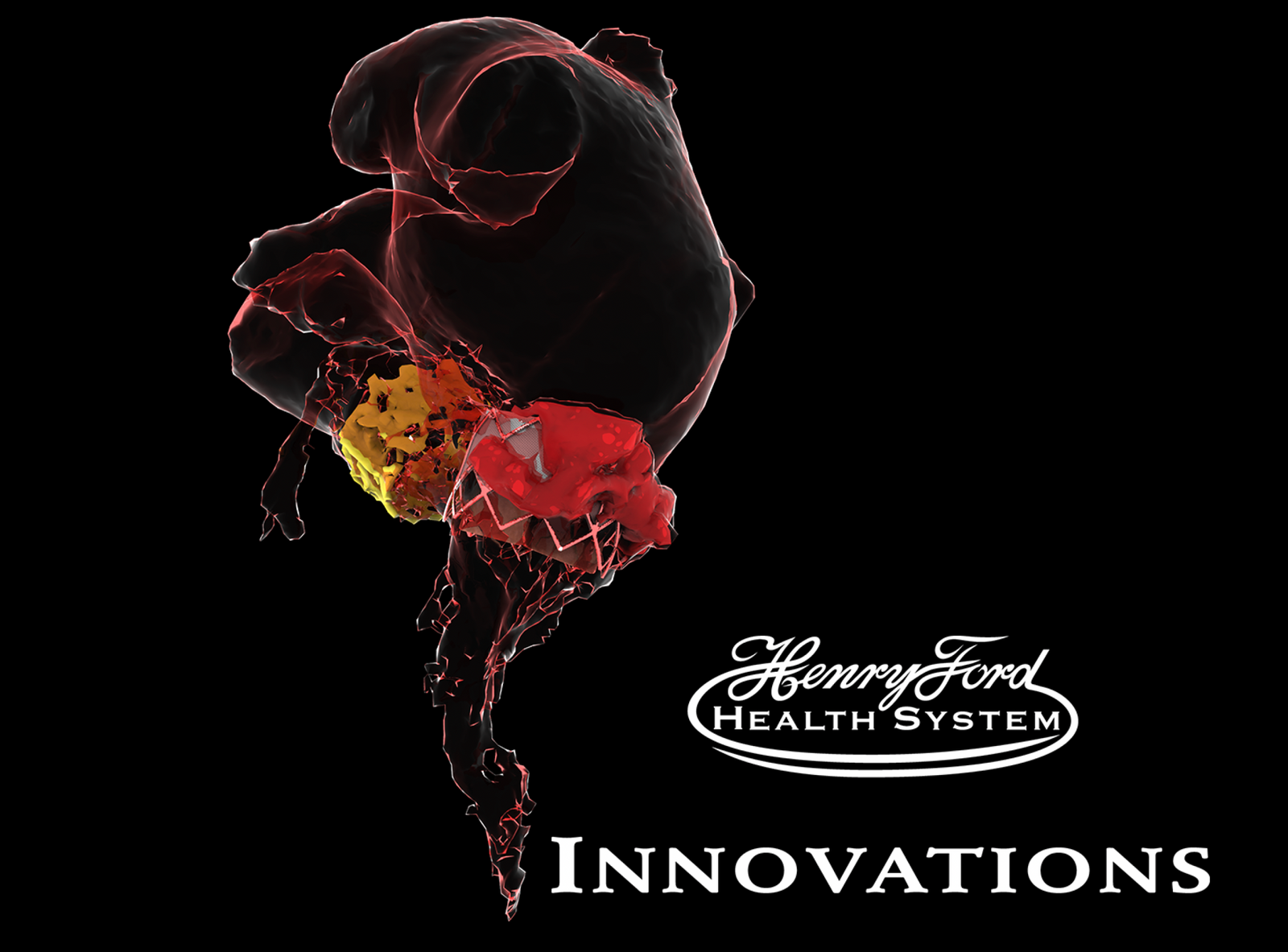 Structural Heart Research